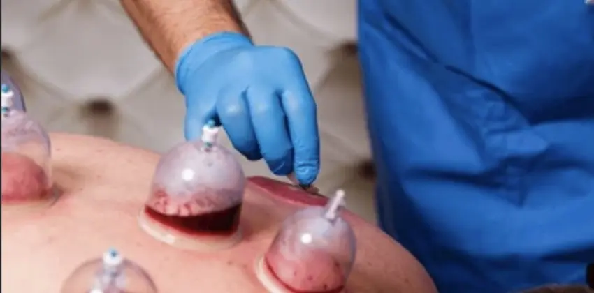 Hijama Institute USA