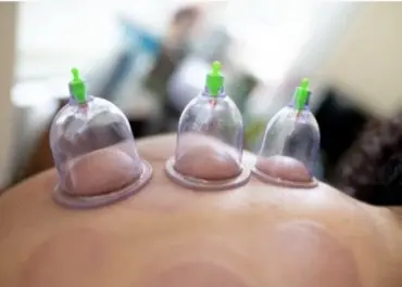 Hijama Institute USA